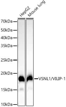 Western Blot: visinin-like 1 Antibody (0R1V3) [NBP3-33331] - Western blot analysis of various lysates using visinin-like 1 Rabbit mAb at1:2000 dilution.Secondary antibody: HRP-conjugated Goat anti-Rabbit IgG (H+L) at 1:10000 dilution.Lysates/proteins: 25ug per lane.Blocking buffer: 3% nonfat dry milk in TBST.Detection: ECL Basic Kit.Exposure time: 10s.