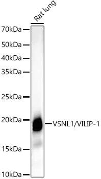 Western Blot: visinin-like 1 Antibody (0R1V3) [NBP3-33331] - Western blot analysis of various lysates using visinin-like 1 Rabbit mAb at1:2000 dilution.Secondary antibody: HRP-conjugated Goat anti-Rabbit IgG (H+L) at 1:10000 dilution.Lysates/proteins: 25ug per lane.Blocking buffer: 3% nonfat dry milk in TBST.Detection: ECL Basic Kit.Exposure time: 30s.