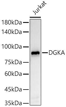 Western Blot: DGK-alpha Antibody (5T6O5) [NBP3-33332] - Western blot analysis of lysates from Jurkat cells, using DGK-alpha Rabbit mAb at1:2000 dilution.Secondary antibody: HRP-conjugated Goat anti-Rabbit IgG (H+L) at 1:10000 dilution.Lysates/proteins: 25ug per lane.Blocking buffer: 3% nonfat dry milk in TBST.Detection: ECL Basic Kit.Exposure time: 30s.