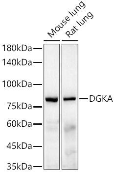 Western Blot: DGK-alpha Antibody (5T6O5) [NBP3-33332] - Western blot analysis of various lysates, using DGK-alpha Rabbit mAb at1:2000 dilution.Secondary antibody: HRP-conjugated Goat anti-Rabbit IgG (H+L) at 1:10000 dilution.Lysates/proteins: 25ug per lane.Blocking buffer: 3% nonfat dry milk in TBST.Detection: ECL Enhanced Kit.Exposure time: 60s.