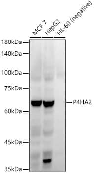 Western Blot: P4HA2 Antibody (6A6Z2) [NBP3-33334] - Western blot analysis of various lysates, using P4HA2 Rabbit mAb at1:20000 dilution.Secondary antibody: HRP-conjugated Goat anti-Rabbit IgG (H+L) at 1:10000 dilution.Lysates/proteins: 25ug per lane.Blocking buffer: 3% nonfat dry milk in TBST.Detection: ECL Enhanced Kit.Exposure time: 60s.