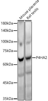 Western Blot: P4HA2 Antibody (6A6Z2) [NBP3-33334] - Western blot analysis of various lysates, using P4HA2 Rabbit mAb at1:20000 dilution.Secondary antibody: HRP-conjugated Goat anti-Rabbit IgG (H+L) at 1:10000 dilution.Lysates/proteins: 25ug per lane.Blocking buffer: 3% nonfat dry milk in TBST.Detection: ECL Enhanced Kit.Exposure time: 180s.