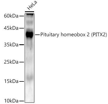 Western Blot: PITX2 Antibody (6X1W3) [NBP3-33337] - Western blot analysis of lysates from HeLa cells, using PITX2(PITX2) Rabbit mAb at1:2000 dilution.Secondary antibody: HRP-conjugated Goat anti-Rabbit IgG (H+L) at 1:10000 dilution.Lysates/proteins: 25ug per lane.Blocking buffer: 3% nonfat dry milk in TBST.Detection: ECL Enhanced Kit.Exposure time: 90s.