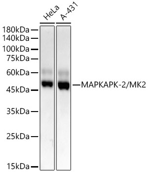 Western Blot: MAPKAPK2 Antibody (3S9N5) [NBP3-33338] - Western blot analysis of various lysates, using MAPKAPK2 Rabbit mAb at1:2000 dilution.Secondary antibody: HRP-conjugated Goat anti-Rabbit IgG (H+L) at 1:10000 dilution.Lysates/proteins: 25ug per lane.Blocking buffer: 3% nonfat dry milk in TBST.Detection: ECL Basic Kit.Exposure time: 30s.