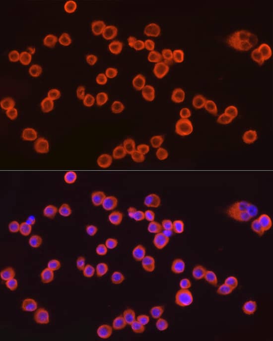 Immunocytochemistry/ Immunofluorescence: CMTM6 Antibody (7N3H5) [NBP3-33341] - Immunofluorescence analysis of RAW264.7 cells using CMTM6 Rabbit mAb at dilution of 1:100 (40x lens). Secondary antibody: Cy3-conjugated Goat anti-Rabbit IgG (H+L) at 1:500 dilution. Blue: DAPI for nuclear staining.