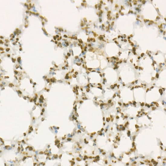 Immunohistochemistry: Wee1 Antibody (6V1Y6) [NBP3-33344] - Immunohistochemistry analysis of paraffin-embedded Mouse lung using Wee1 Rabbit mAb at dilution of 1:100 (40x lens). High pressure antigen retrieval performed with 0.01M Citrate Bufferr (pH 6.0) prior to IHC staining.