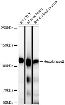 Western Blot: Hexokinase 2 Antibody (5Z8C3) [NBP3-33349] - Western blot analysis of lysates from Mouse skeletal muscle using [KO Validated] Hexokinase 2 Rabbit mAb at 1:25000 dilution incubated overnight at 4C.Secondary antibody: HRP-conjugated Goat anti-Rabbit IgG (H+L) at 1:10000 dilution.Lysates/proteins: 25 ug per lane.Blocking buffer: 3% nonfat dry milk in TBST.Detection: ECL Basic Kit.Exposure time: 10s.