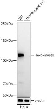 Western Blot: Hexokinase 2 Antibody (5Z8C3) [NBP3-33349] - Western blot analysis of various lysates using [KO Validated] Hexokinase 2 Rabbit mAb at 1:25000 dilution incubated overnight at 4C.Secondary antibody: HRP-conjugated Goat anti-Rabbit IgG (H+L) at 1:10000 dilution.Lysates/proteins: 25 ug per lane.Blocking buffer: 3% nonfat dry milk in TBST.Detection: ECL Basic Kit.Exposure time: 30s.