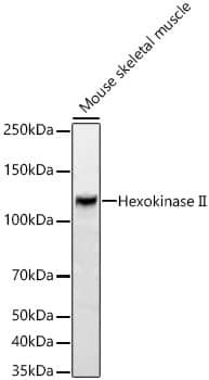 Western Blot: Hexokinase 2 Antibody (5Z8C3) [NBP3-33349] - Western blot analysis of various lysates using [KO Validated] Hexokinase 2 Rabbit mAb at 1:25000 dilution incubated overnight at 4C.Secondary antibody: HRP-conjugated Goat anti-Rabbit IgG (H+L) at 1:10000 dilution.Lysates/proteins: 25 ug per lane.Blocking buffer: 3% nonfat dry milk in TBST.Detection: ECL Basic Kit.Exposure time: 30s.