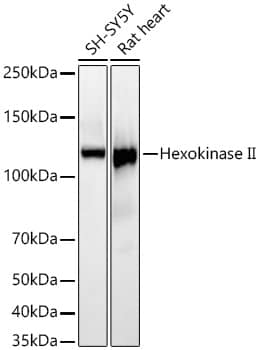 Western Blot: Hexokinase 2 Antibody (5Z8C3) [NBP3-33349] - Western blot analysis of lysates from Mouse skeletal muscle using [KO Validated] Hexokinase 2 Rabbit mAb at 1:25000 dilution incubated overnight at 4C.Secondary antibody: HRP-conjugated Goat anti-Rabbit IgG (H+L) at 1:10000 dilution.Lysates/proteins: 25 ug per lane.Blocking buffer: 3% nonfat dry milk in TBST.Detection: ECL Basic Kit.Exposure time: 10s.