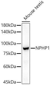 Western Blot: Nephronophthisis Antibody (5M1T6) [NBP3-33350] - Western blot analysis of lysates from Mouse testis, using Nephronophthisis Rabbit mAb at 1:1000 dilution.Secondary antibody: HRP-conjugated Goat anti-Rabbit IgG (H+L) at 1:10000 dilution.Lysates/proteins: 25ug per lane.Blocking buffer: 3% nonfat dry milk in TBST.Detection: ECL Basic Kit.Exposure time: 180s.