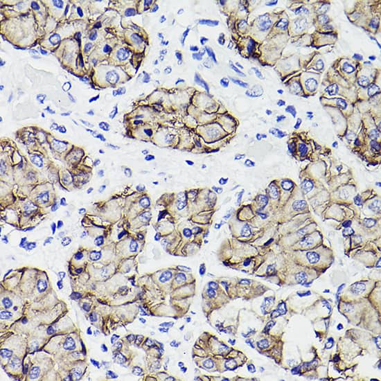 Immunohistochemistry: Claudin-18.2 Antibody (3B2B5) [NBP3-33351] - Immunohistochemistry analysis of paraffin-embedded Human stomach using Claudin-18.2 Rabbit mAb at dilution of 1:400 (40x lens). Microwave antigen retrieval performed with 0.01M Tris/EDTA Buffer (pH 9.0) prior to IHC staining.