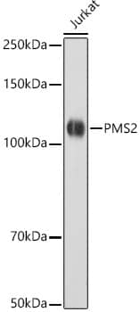 Western Blot: PMS2 Antibody (4T9W4) [NBP3-33352] - Western blot analysis of lysates from Jurkat cells, using [KO Validated] PMS2 Rabbit mAb at  1:1000 dilution.Secondary antibody: HRP-conjugated Goat anti-Rabbit IgG (H+L) at 1:10000 dilution.Lysates/proteins: 25ug per lane.Blocking buffer: 3% nonfat dry milk in TBST.Detection: ECL Basic Kit.Exposure time: 10s.