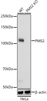 <b>Genetic Strategies Validation. </b>Western Blot: PMS2 Antibody (4T9W4) [NBP3-33352] - Western blot analysis of lysates from wild type (WT) and PMS2 knockout (KO) HeLa cells, using [KO Validated] PMS2 Rabbit mAb at 1:1000 dilution.Secondary antibody: HRP Goat Anti-Rabbit IgG (H+L) at 1:10000 dilution.Lysates/proteins: 25ug per lane.Blocking buffer: 3% nonfat dry milk in TBST.Detection: ECL Basic Kit.Exposure time: 10s.