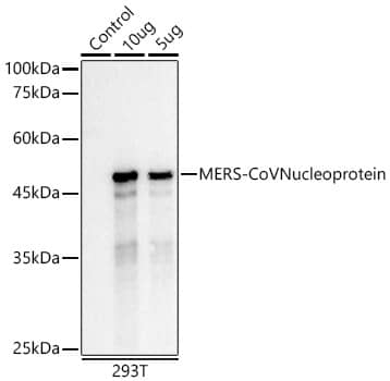 Western Blot: MERS-CoV Nucleoprotein Antibody (5H5T6) [NBP3-33353] - Western blot analysis of lysates from 293T cells, using MERS-CoV Nucleoprotein Rabbit mAb at 1:3000 dilution.Secondary antibody: HRP-conjugated Goat anti-Rabbit IgG (H+L) at 1:10000 dilution.Lysates/proteins: 25ug per lane.Blocking buffer: 3% nonfat dry milk in TBST.Detection: ECL Basic Kit.Exposure time: 1s.