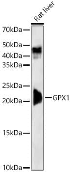 Western Blot: Glutathione Peroxidase 1/GPX1 Antibody (9E5H3) [NBP3-33354] - Western blot analysis of lysates from Rat liver, using Glutathione Peroxidase 1/GPX1 Rabbit mAb at 1:2000 dilution.Secondary antibody: HRP-conjugated Goat anti-Rabbit IgG (H+L) at 1:10000 dilution.Lysates/proteins: 25ug per lane.Blocking buffer: 3% nonfat dry milk in TBST.Detection: ECL Basic Kit.Exposure time: 30s.