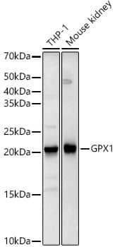 Western Blot: Glutathione Peroxidase 1/GPX1 Antibody (9E5H3) [NBP3-33354] - Western blot analysis of various lysates, using Glutathione Peroxidase 1/GPX1 Rabbit mAb at 1:2000 dilution.Secondary antibody: HRP-conjugated Goat anti-Rabbit IgG (H+L) at 1:10000 dilution.Lysates/proteins: 25ug per lane.Blocking buffer: 3% nonfat dry milk in TBST.Detection: ECL Basic Kit.Exposure time: 3s.