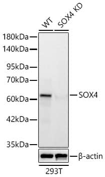 <b>Genetic Strategies Validation. </b>Western Blot: SOX4 Antibody (4A1E8) [NBP3-33358] - Western blot analysis of lysates from wild type (WT) and SOX4 knockdown (KD) 293T cells using SOX4 Rabbit mAb at 1:5000 dilution incubated overnight at 4C.Secondary antibody: HRP-conjugated Goat anti-Rabbit IgG (H+L) at 1:10000 dilution.Lysates/proteins: 25 ug per lane.Blocking buffer: 3% nonfat dry milk in TBST.Detection: ECL Basic Kit.Exposure time: 30s.