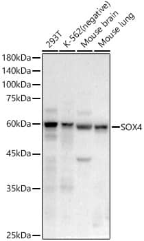 Western Blot: SOX4 Antibody (4A1E8) [NBP3-33358] - Western blot analysis of various lysates, using SOX4 Rabbit mAb at 1:20000 dilution.Secondary antibody: HRP-conjugated Goat anti-Rabbit IgG (H+L) at 1:10000 dilution.Lysates/proteins: 25ug per lane.Blocking buffer: 3% nonfat dry milk in TBST.Detection: ECL Basic Kit.Exposure time: 30s.