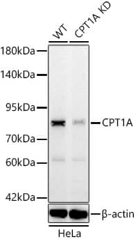 <b>Genetic Strategies Validation. </b>Western Blot: CPT1A Antibody (8Y1J4) [NBP3-33364] - Western blot analysis of lysates from wild type (WT) and CPT1A knockdown (KD) HeLa cells using [KD Validated] CPT1A Rabbit mAb at 1:1000 dilution incubated overnight at 4C.Secondary antibody: HRP-conjugated Goat anti-Rabbit IgG (H+L) at 1:10000 dilution.Lysates/proteins: 25 ug per lane.Blocking buffer: 3% nonfat dry milk in TBST.Detection: ECL Basic Kit.Exposure time: 45s.