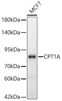 Western Blot: CPT1A Antibody (8Y1J4) [NBP3-33364] - Western blot analysis of lysates from MCF7 cells using [KD Validated] CPT1A Rabbit mAb at 1:1000 dilution incubated overnight at 4C.Secondary antibody: HRP-conjugated Goat anti-Rabbit IgG (H+L) at 1:10000 dilution.Lysates/proteins: 25 ug per lane.Blocking buffer: 3% nonfat dry milk in TBST.Detection: ECL Basic Kit.Exposure time: 45s.