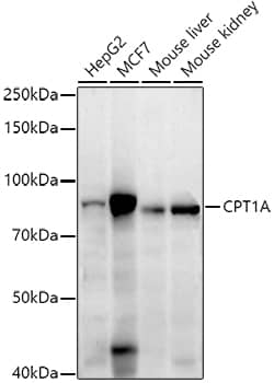 Western Blot: CPT1A Antibody (8Y1J4) [NBP3-33364] - Western blot analysis of lysates from MCF7 cells using [KD Validated] CPT1A Rabbit mAb at 1:1000 dilution incubated overnight at 4C.Secondary antibody: HRP-conjugated Goat anti-Rabbit IgG (H+L) at 1:10000 dilution.Lysates/proteins: 25 ug per lane.Blocking buffer: 3% nonfat dry milk in TBST.Detection: ECL Basic Kit.Exposure time: 45s.