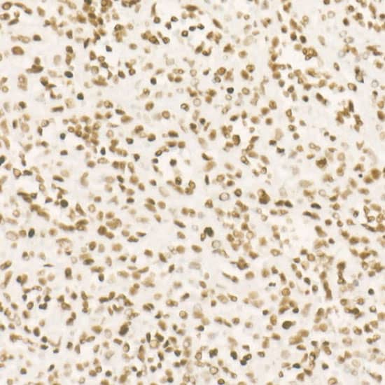 Immunohistochemistry: CDK12 Antibody (9X2D10) [NBP3-33365] - Immunohistochemistry analysis of paraffin-embedded Human spleen using CDK12 Rabbit mAb at dilution of 1:500 (40x lens). High pressure antigen retrieval performed with 0.01M Citrate Bufferr (pH 6.0) prior to IHC staining.