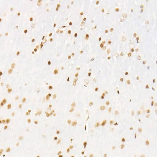 Immunohistochemistry: CDK12 Antibody (9X2D10) [NBP3-33365] - Immunohistochemistry analysis of paraffin-embedded Mouse brain using CDK12 Rabbit mAb at dilution of 1:500 (40x lens). High pressure antigen retrieval performed with 0.01M Citrate Bufferr (pH 6.0) prior to IHC staining.