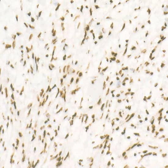 Immunohistochemistry: CDK12 Antibody (9X2D10) [NBP3-33365] - Immunohistochemistry analysis of paraffin-embedded Human heart using CDK12 Rabbit mAb at dilution of 1:500 (40x lens). High pressure antigen retrieval performed with 0.01M Citrate Bufferr (pH 6.0) prior to IHC staining.