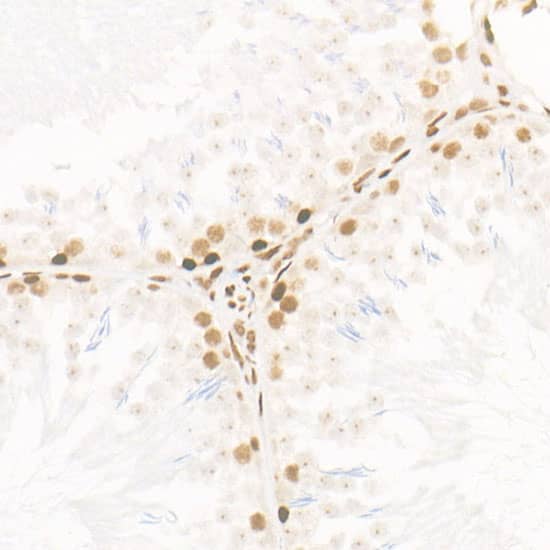 Immunohistochemistry: CDK12 Antibody (9X2D10) [NBP3-33365] - Immunohistochemistry analysis of paraffin-embedded Rat testis using CDK12 Rabbit mAb at dilution of 1:500 (40x lens). High pressure antigen retrieval performed with 0.01M Citrate Bufferr (pH 6.0) prior to IHC staining.