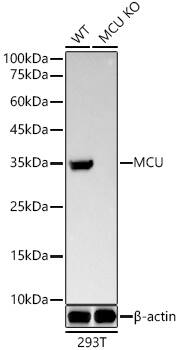<b>Genetic Strategies Validation. </b>Western Blot: CCDC109A Antibody (5G2I5) [NBP3-33367] - Western blot analysis of lysates from wild type(WT) and CCDC109A knockout (KO) 293T(KO) cells, using [KO Validated] CCDC109A Rabbit mAb at1:20000 dilution.Secondary antibody: HRP-conjugated Goat anti-Rabbit IgG (H+L) at 1:10000 dilution.Lysates/proteins: 25ug per lane.Blocking buffer: 3% nonfat dry milk in TBST.Detection: ECL Basic Kit.Exposure time: 90s.
