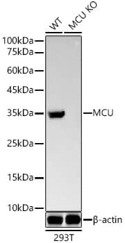 <b>Genetic Strategies Validation. </b>Western Blot: CCDC109A Antibody (5G2I5) [CCDC109A] - Western blot analysis of lysates from wild type(WT) and CCDC109A knockout (KO) 293T(KO) cells, using [KO Validated] CCDC109A Rabbit mAb  at1:20000 dilution.Secondary antibody: HRP-conjugated Goat anti-Rabbit IgG (H+L)  at 1:10000 dilution.Lysates/proteins: 25ug per lane.Blocking buffer: 3% nonfat dry milk in TBST.Detection: ECL Basic Kit .Exposure time: 90s.