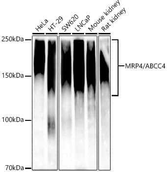 Western Blot: MRP4/ABCC4 Antibody (9W2S0) [NBP3-33369] - Western blot analysis of various lysates, using [KD Validated] MRP4/ABCC4 Rabbit mAb at 1:1000 dilution.Secondary antibody: HRP-conjugated Goat anti-Rabbit IgG (H+L) at 1:10000 dilution.Lysates/proteins: 25ug per lane.Blocking buffer: 3% nonfat dry milk in TBST.Detection: ECL Basic Kit.Exposure time: 90s.