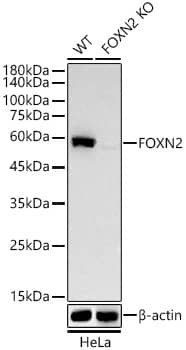 Western Blot: FOXN2 Antibody (9K7D9) [NBP3-33372] - Western blot analysis of extracts from wild type (WT) and FOXN2 knockout (KO) HeLa(KO) cells, using [KO Validated] FOXN2 Rabbit mAb at 1:1000 dilution.Secondary antibody: HRP Goat Anti-Rabbit IgG (H+L) at 1:10000 dilution.Lysates/proteins: 25ug per lane.Blocking buffer: 3% nonfat dry milk in TBST.Detection: ECL Basic Kit.Exposure time: 10s.