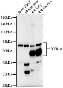 Western Blot: Fc epsilon RI alpha Antibody (7R2U2) [NBP3-33377] - Western blot analysis of various lysates, using Fc epsilon RI alpha Rabbit mAb at  1:6000 dilution.Secondary antibody: HRP-conjugated Goat anti-Rabbit IgG (H+L) at 1:10000 dilution.Lysates/proteins: 25ug per lane.Blocking buffer: 3% nonfat dry milk in TBST.Detection: ECL Basic Kit.Exposure time: 90s.