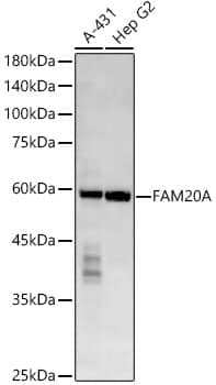 Western Blot: FAM20A Antibody (2I9B0) [NBP3-33384] - Western blot analysis of various lysates, using FAM20A Rabbit mAb at  1:20000 dilution.Secondary antibody: HRP-conjugated Goat anti-Rabbit IgG (H+L) at 1:10000 dilution.Lysates/proteins: 25ug per lane.Blocking buffer: 3% nonfat dry milk in TBST.Detection: ECL Enhanced Kit.Exposure time: 180s.