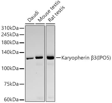 Western Blot: Karyopherin (importin) beta 3 Antibody (10K10W2) [NBP3-33386] - Western blot analysis of various lysates, using Karyopherin (importin) beta 3(IPO5) Rabbit mAb at  1:10000 dilution.Secondary antibody: HRP-conjugated Goat anti-Rabbit IgG (H+L) at 1:10000 dilution.Lysates/proteins: 25ug per lane.Blocking buffer: 3% nonfat dry milk in TBST.Detection: ECL Basic Kit.Exposure time: 180s.