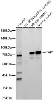 Western Blot TAP1 Antibody (6Q8Q5)