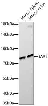 Western Blot: TAP1 Antibody (6Q8Q5) [TAP1] - Western blot analysis of various lysates, using TAP1 Rabbit mAb  at  1:10000 dilution.Secondary antibody: HRP Goat Anti-Rabbit IgG (H+L)  at 1:10000 dilution.Lysates/proteins: 25ug per lane.Blocking buffer: 3% nonfat dry milk in TBST.Detection: ECL Enhanced Kit .Exposure time: 180s.