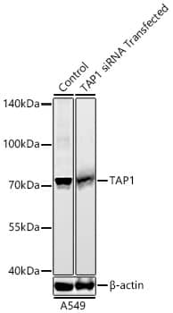Western Blot: TAP1 Antibody (6Q8Q5) [TAP1] - Western blot analysis of lysates from A549 cells transfected with TAP1 siRNA using TAP1 Rabbit mAb  at 1:5000 dilution incubated overnight at 4C.Secondary antibody: HRP-conjugated Goat anti-Rabbit IgG (H+L) at 1:10000 dilution. Lysates/proteins: 30 ug per lane.Blocking buffer: 3% nonfat dry milk in TBST.Detection: ECL Basic Kit Exposure time: 180 s.