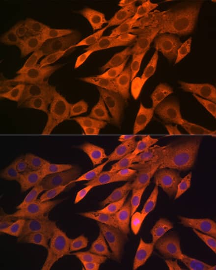 Immunocytochemistry/ Immunofluorescence SRP54 Antibody (1O3J1)