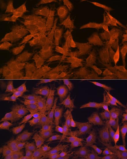 Immunocytochemistry/ Immunofluorescence SRP54 Antibody (1O3J1)