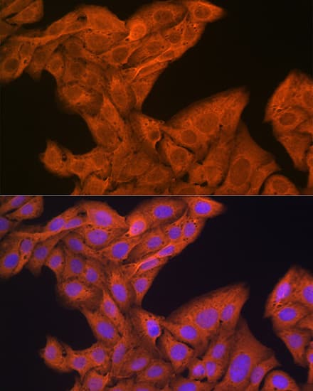 Immunocytochemistry/ Immunofluorescence: SRP54 Antibody (1O3J1) [NBP3-33390] - Immunofluorescence analysis of U-2 OS cells using SRP54 Rabbit mAb at dilution of 1:100 (40x lens). Secondary antibody: Cy3-conjugated Goat anti-Rabbit IgG (H+L) at 1:500 dilution. Blue: DAPI for nuclear staining.