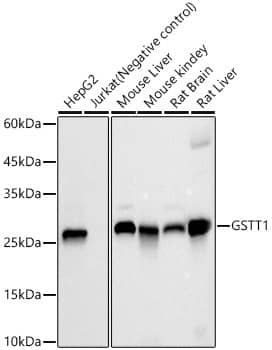 Western Blot: GSTT1 Antibody (2A7N6) [NBP3-33392] - Western blot analysis of various lysates, using GSTT1 Rabbit mAb at  1:2000 dilution.Secondary antibody: HRP-conjugated Goat anti-Rabbit IgG (H+L) at 1:10000 dilution.Lysates/proteins: 25ug per lane.Blocking buffer: 3% nonfat dry milk in TBST.Detection: ECL Basic Kit.Exposure time: 10s.