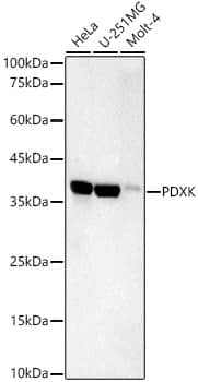 Western Blot: Pyridoxal Kinase/PDXK Antibody (5N4M3) [NBP3-33395] - Western blot analysis of various lysates, using Pyridoxal Kinase/PDXK Rabbit mAb at  1:1000 dilution.Secondary antibody: HRP-conjugated Goat anti-Rabbit IgG (H+L) at 1:10000 dilution.Lysates/proteins: 25ug per lane.Blocking buffer: 3% nonfat dry milk in TBST.Detection: ECL Basic Kit.Exposure time: 90s.