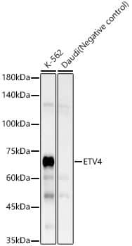 Western Blot: Pea3 Antibody (10I1V4) [NBP3-33399] - Western blot analysis of various lysates, using Pea3 Rabbit mAb at 1:8000 dilution.Secondary antibody: HRP-conjugated Goat anti-Rabbit IgG (H+L) at 1:10000 dilution.Lysates/proteins: 25ug per lane.Blocking buffer: 3% nonfat dry milk in TBST.Detection: ECL Enhanced Kit.Exposure time: 120s.