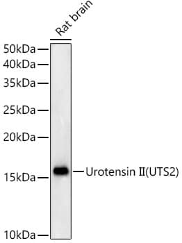 Western Blot: Urotensin-2 Antibody (3B2M6) [NBP3-33403] - Western blot analysis of lysates from Rat brain, using Urotensin-2(UTS2) Rabbit mAb at 1:500 dilution.Secondary antibody: HRP-conjugated Goat anti-Rabbit IgG (H+L) at 1:10000 dilution.Lysates/proteins: 25ug per lane.Blocking buffer: 3% nonfat dry milk in TBST.Detection: ECL Basic Kit.Exposure time: 180s.