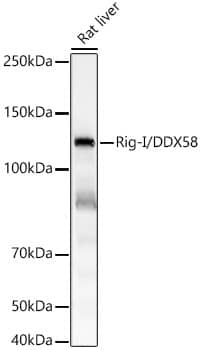 Western Blot: RIG-I Antibody (3E1C6) [NBP3-33405] - Western blot analysis of lysates from rat liver, using RIG-I Rabbit mAb at 1:4000 dilution.Secondary antibody: HRP-conjugated Goat anti-Rabbit IgG (H+L) at 1:10000 dilution.Lysates/proteins: 25ug per lane.Blocking buffer: 3% nonfat dry milk in TBST.Detection: ECL Basic Kit.Exposure time: 10s.