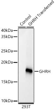 Western Blot: GHRH Antibody (8G5Y9) [NBP3-33413] - Western blot analysis of lysates from wild type (WT) and 293T cells transfected with GHRH using GHRH Rabbit mAb at 1:1000 dilution incubated overnight at 4℃.Secondary antibody: HRP-conjugated Goat anti-Rabbit IgG (H+L) at 1:10000 dilution.Lysates/proteins: 25 μg per lane.Blocking buffer: 3% nonfat dry milk in TBST.Detection: ECL Basic Kit.Exposure time: 30s.