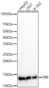 Western Blot: ACBP Antibody (2N0A7) [NBP3-33415] - Western blot analysis of various lysates, using ACBP Rabbit mAb at 1:1000 dilution.Secondary antibody: HRP-conjugated Goat anti-Rabbit IgG (H+L) at 1:10000 dilution.Lysates/proteins: 25ug per lane.Blocking buffer: 3% nonfat dry milk in TBST.Detection: ECL Basic Kit.Exposure time: 30s.